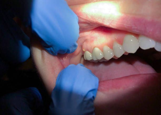 Best Urgent Care for Lost Fillings or Crowns in Weimar, TX