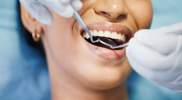 Best Emergency Dental Care for Broken or Chipped Teeth in Weimar, TX