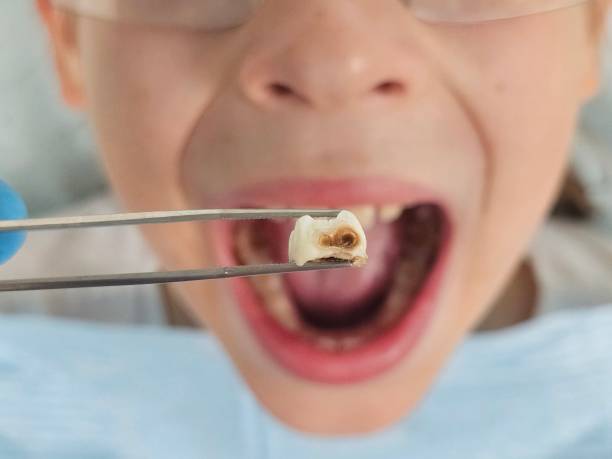 Best Pediatric Emergency Dentist in Weimar, TX